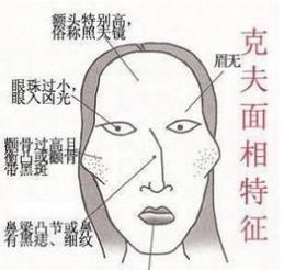 什么面相的女人克夫