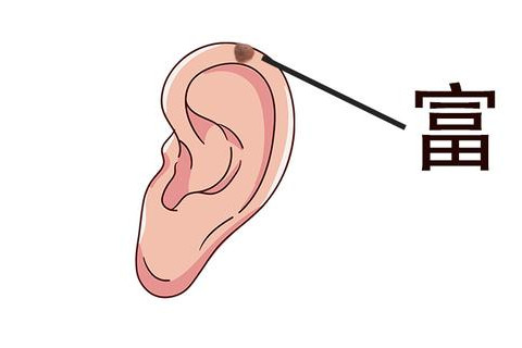 女人左耳朵上的痣有什么含义？